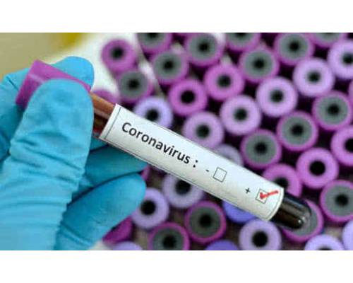 «Особлива думка»: наскільки готова Первомайщина до боротьби з коронавірусом